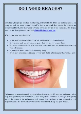 do i need braces