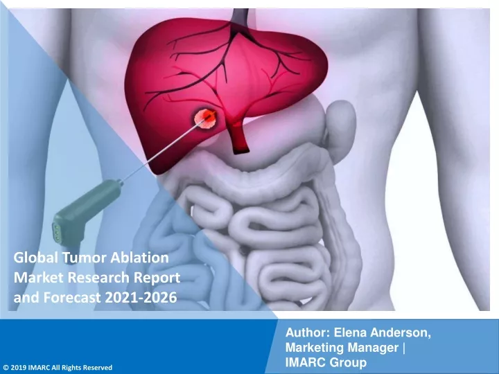 global tumor ablation market research report