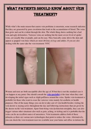 what patients should know about vein what
