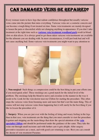 can damaged veins be repaired can damaged veins