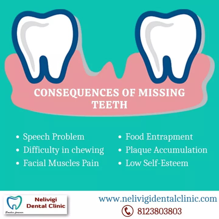 consequences of missing teeth