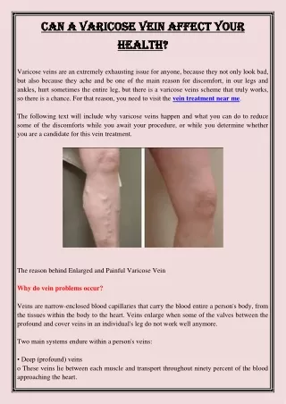can a varicose vein affect your can a varicose