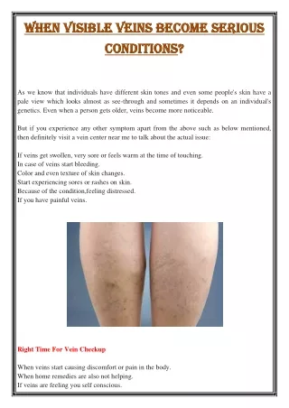 when visible veins become serious when visible