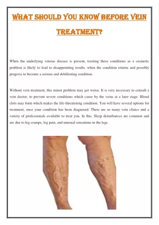 what should you know before vein what should