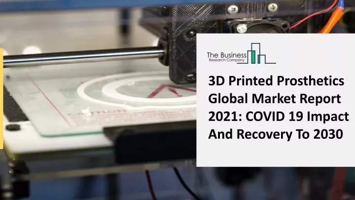 3d printed prosthetics global market report 2021