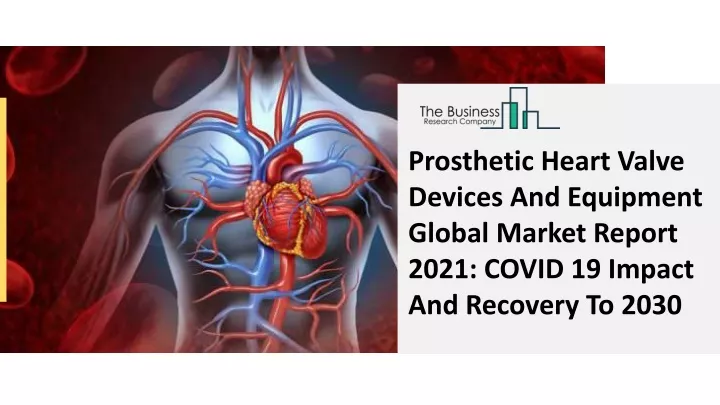 prosthetic heart valve devices and equipment