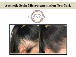 aesthetic scalp micropigmentation new york
