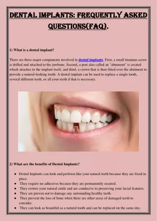 dental implants frequently asked dental implants