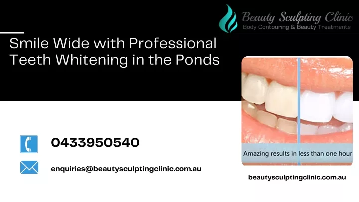 smile wide with professional teeth whitening