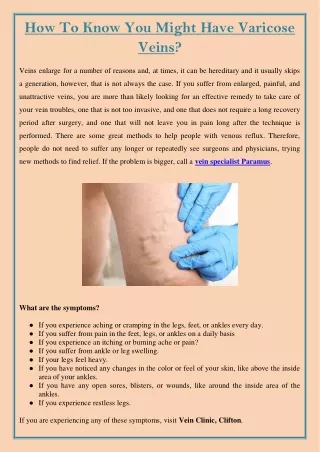 how to know you might have varicose veins