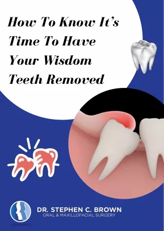 How To Know It’s Time To Have Your Wisdom Teeth Removed