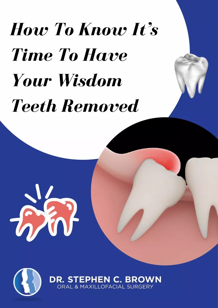how to know it s time to have your wisdom teeth