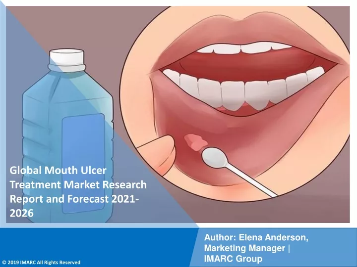 global mouth ulcer treatment market research