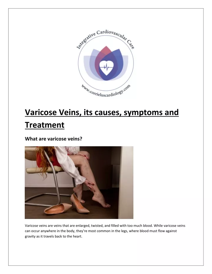 varicose veins its causes symptoms and treatment
