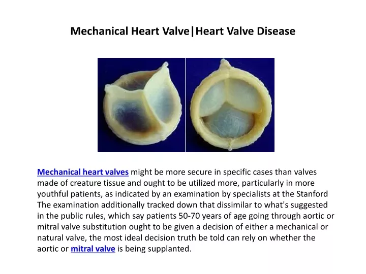 mechanical heart valve heart valve disease