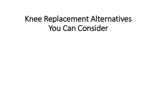 knee replacement alternatives you can consider