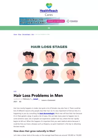 Hair Loss Problems  in Men