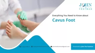 Everything You Need to Know about Cavus Foot