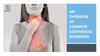 an overview of common esophageal disorders