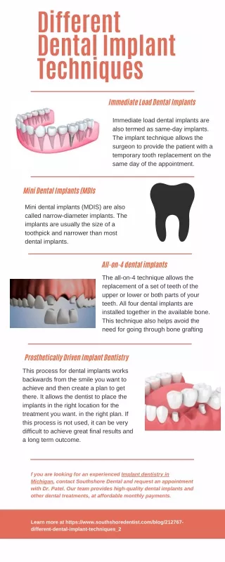 Different Dental Implant Techniques