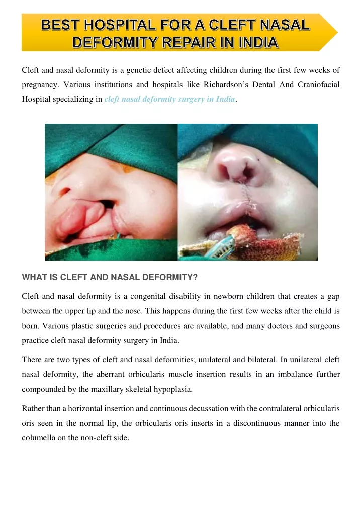 cleft and nasal deformity is a genetic defect