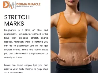 Stretch Mark