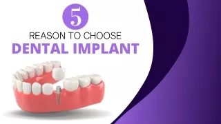 5 Reasons To Choose Dental Implant