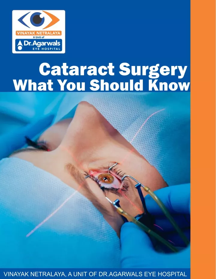 cataract surgery what you should know