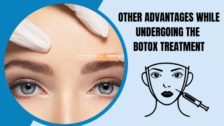 other advantages while undergoing the botox