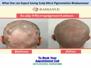 What One can Expect having Scalp Micro Pigmentation Bhubaneswar