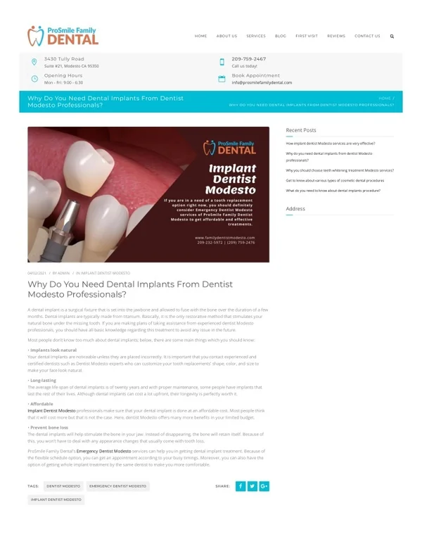 Implant Dentist Modesto