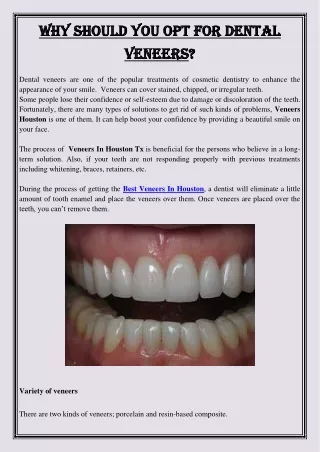 why should you opt for dental why should