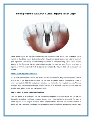 Finding Where to Get All On 4 Dental Implants in San Diego