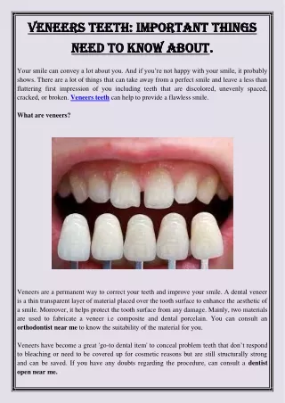 Veneers Teeth  Important Things Need To Know About