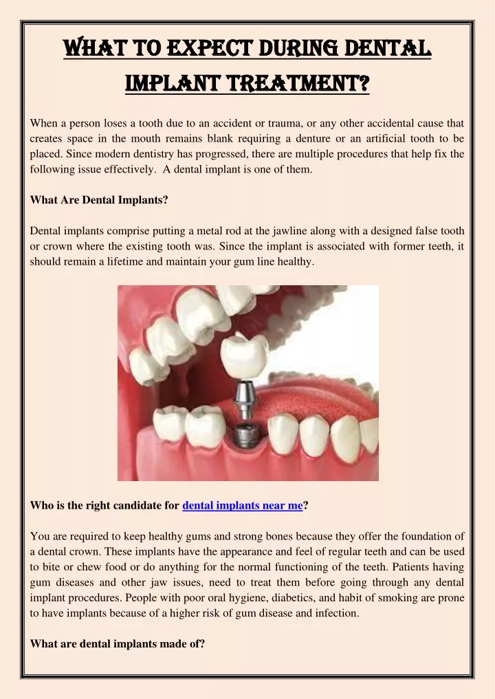 what to expect during dental what to expect