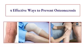 4 Effective Ways to Prevent Osteonecrosis | Avascular Necrosis Pain Management