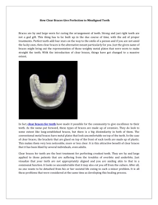 How Clear Braces Give Perfection to Misaligned Teeth