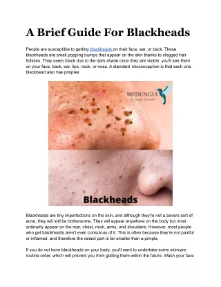 A Brief Guide For Blackheads.docx