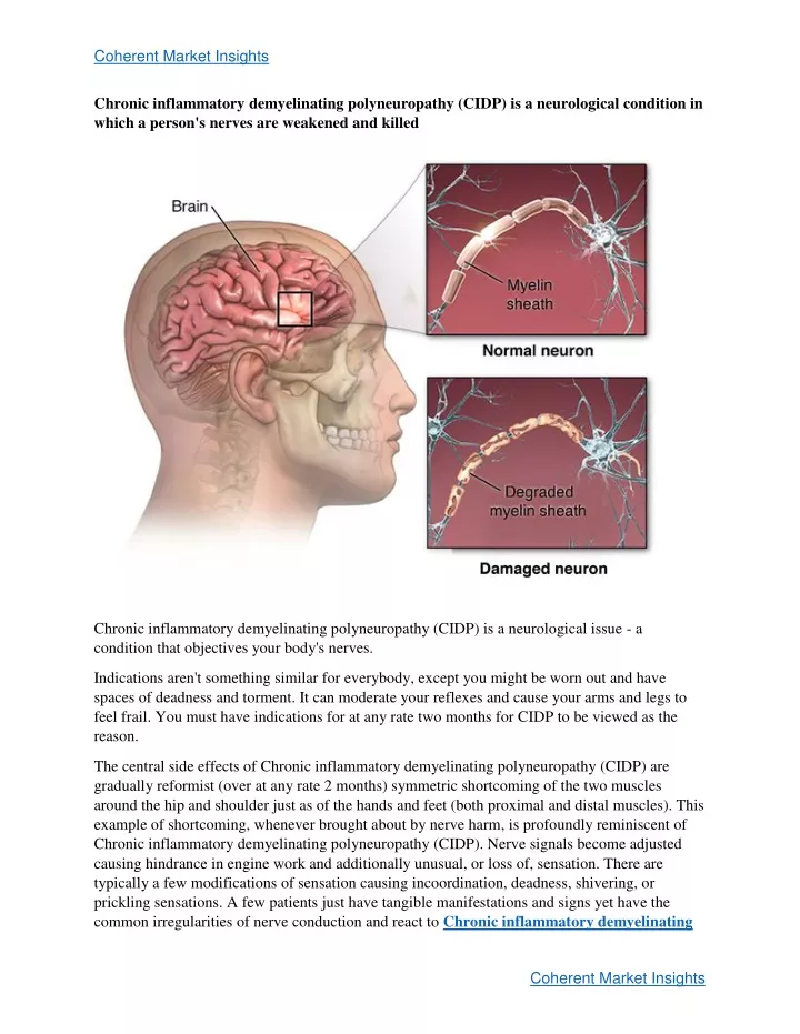 Ppt Chronic Inflammatory Demyelinating Polyneuropathy Cidp Treatment Powerpoint Presentation 