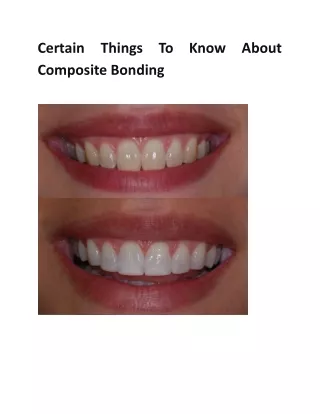 certain composite bonding