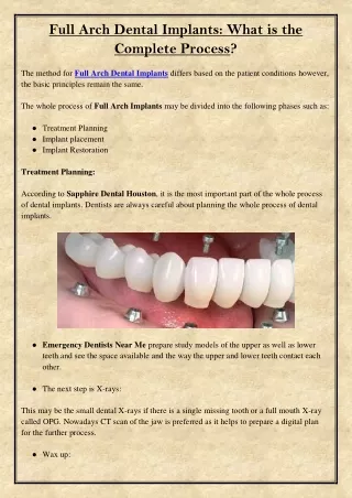 full arch dental implants what is the complete