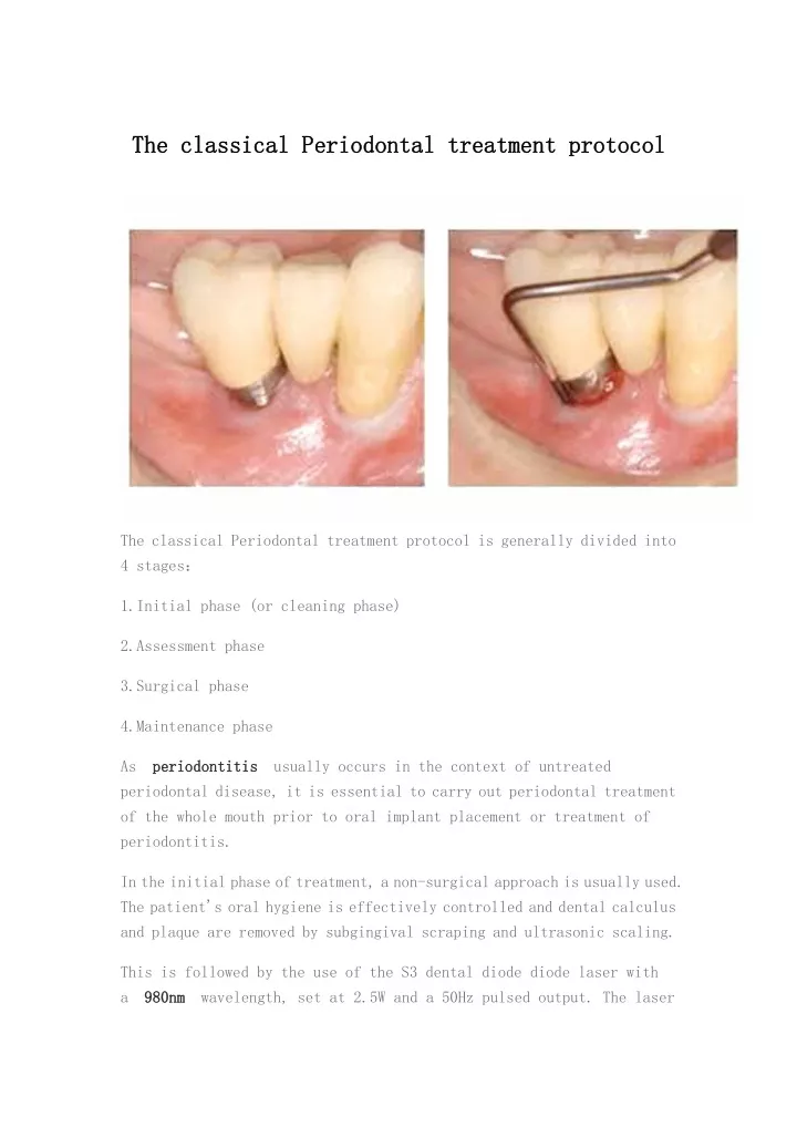 the the classical classical periodontal
