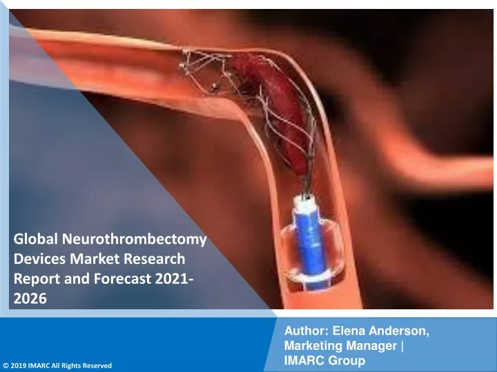 global neurothrombectomy devices market research