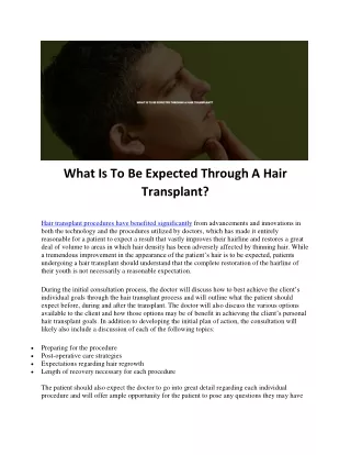 What Is To Be Expected Through A Hair Transplant?