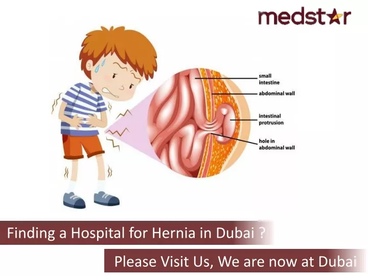 finding a hospital for hernia in dubai