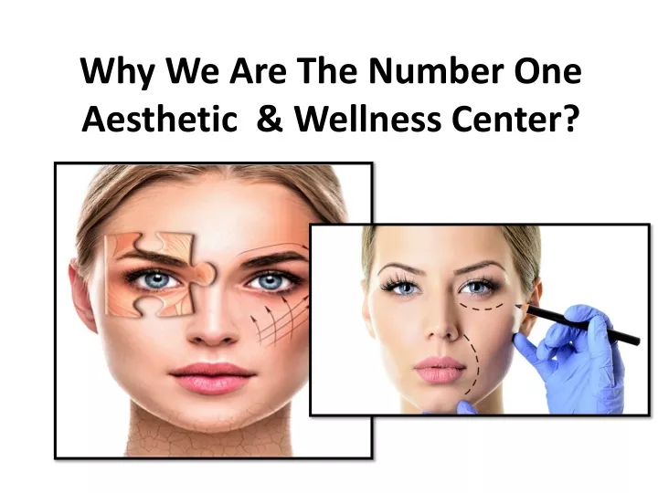 why we are the number one aesthetic wellness center