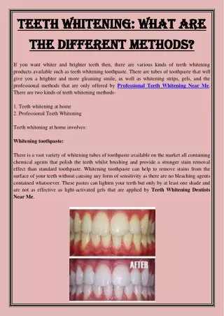 teeth whitening what are teeth whitening what