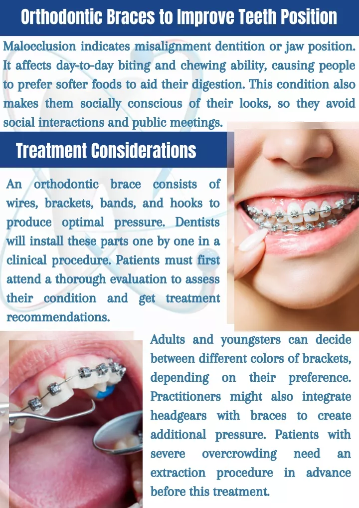 orthodontic braces to improve teeth position
