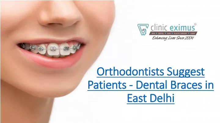 orthodontists suggest patients dental braces in east delhi