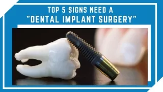 Signs You Might Need Dental Implants